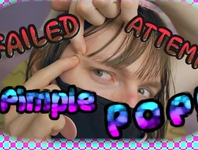 4k undefined Undone ATTEMPT Pimple Pop! (teaser) hot gay porn muscular