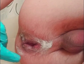 handsome skinny twink give ruptured prolapse makes fisting nigh himself hot sexy asian gay porn