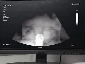 Emergency Dick - Wrap up  MEN   Benjamin Blue, Clark Delgaty, Tony D'Angelo, Dane Jaxson    stream full at  www.sexmen.com star hot young indian gay porn