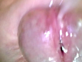 Korslaveman - Sounding with an endoscopic camera well-pleased daddy hot porn